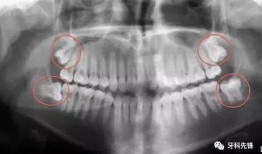 阴牙齿电影在线观看,惊悚悬疑，揭秘恐怖真相
