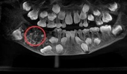 阴牙齿电影在线观看,惊悚悬疑，揭秘恐怖真相